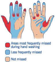 How can Hand Hygiene Prevent the Spread of Disease?